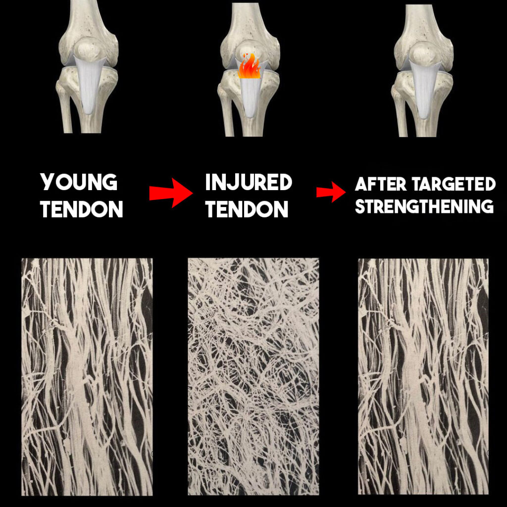Processus de remodelage des tendons après blessure