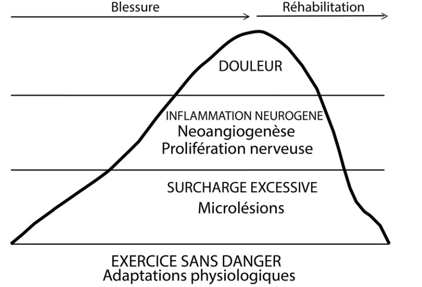 traiter une tendinopathie - Le modèle iceberg