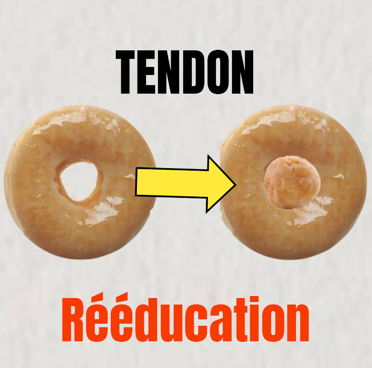 Traiter une tendinopathie - Le modèle du donut